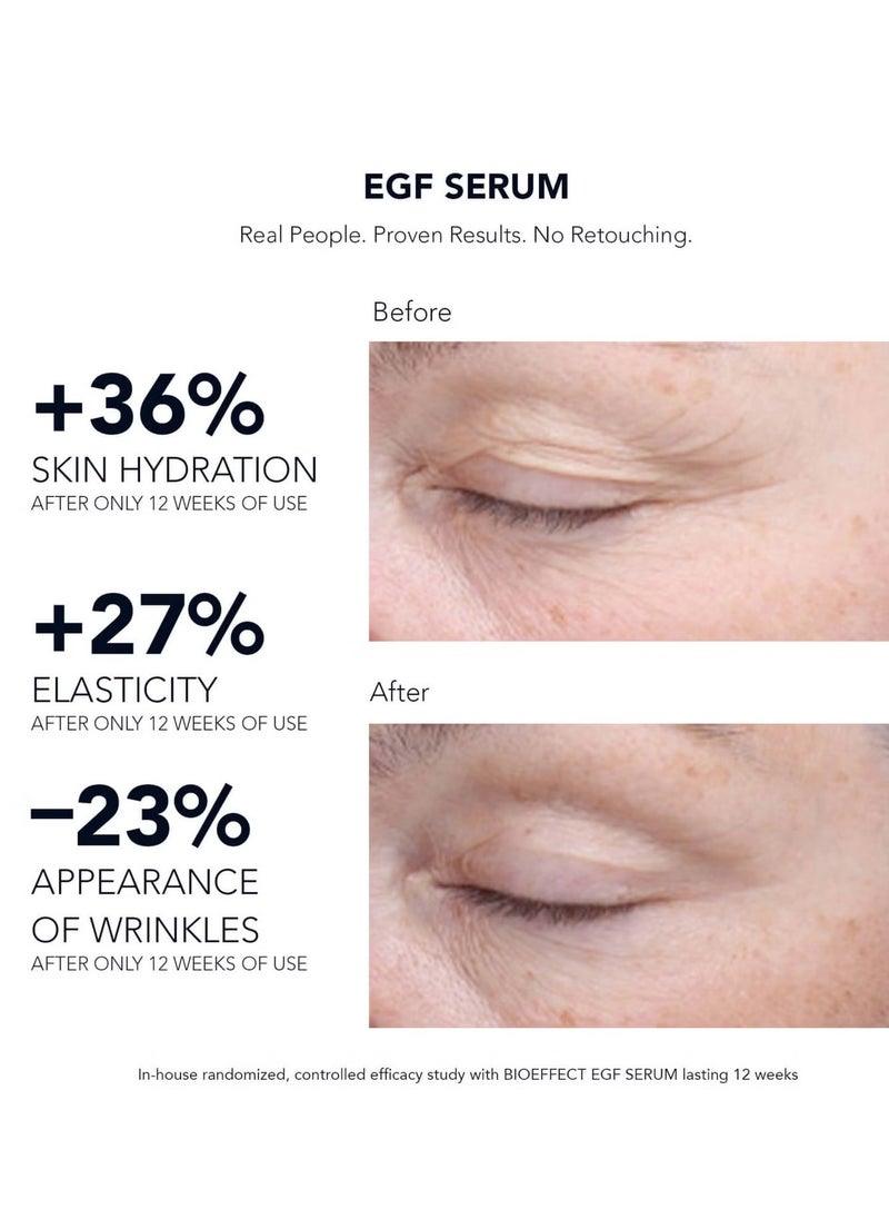BIOEFFECT EGF Serum, 15ml