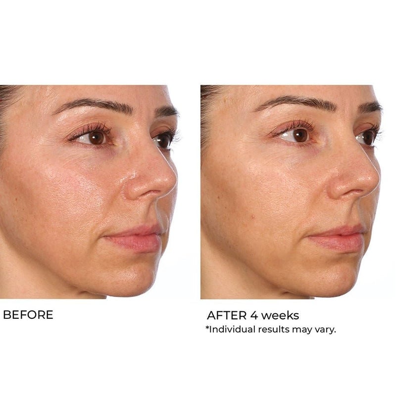 NassifMD Hydro-Gel with Hylauronic Acid Moisturizer, Salicylic Acid Serum, Retinol Serum for Face - Image 5