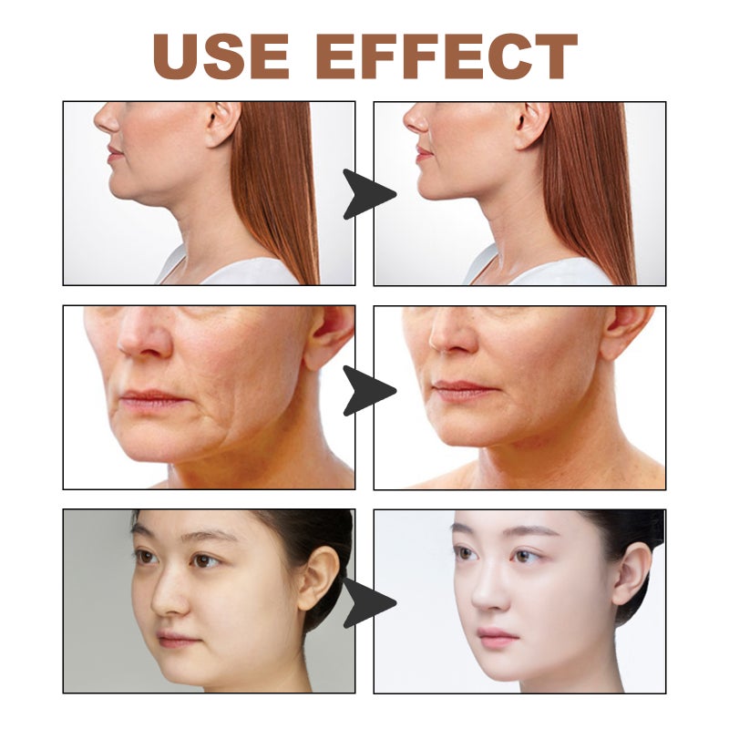 Facial Lifting Tape: 15-30 Uses, Sensitive Skin Friendly, Anti-Wrinkle - Facial Tightening Myofascial Band for Nighttime Skin Rejuvenation Treatment - Image 4