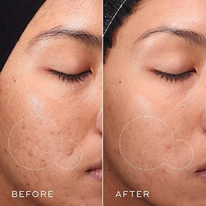 Medik8 مديك8 برس آند كلير - تونر وجه م clarifying - تونر وجه مقشر BHA للنساء والرجال - تونر وجه حمض الساليسيليك بإطلاق لطيف - 5 أونصات - Image 5