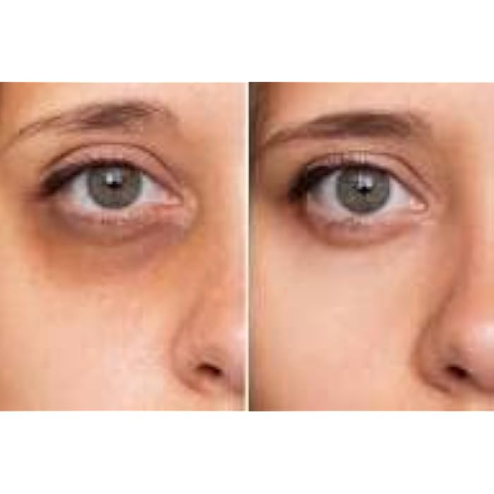 Saly Jolie Miracle EYE care with hyaluronic acid - Image 5