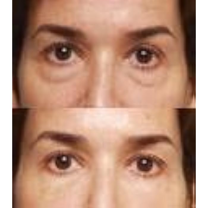 Saly Jolie Miracle EYE care with hyaluronic acid - Image 4