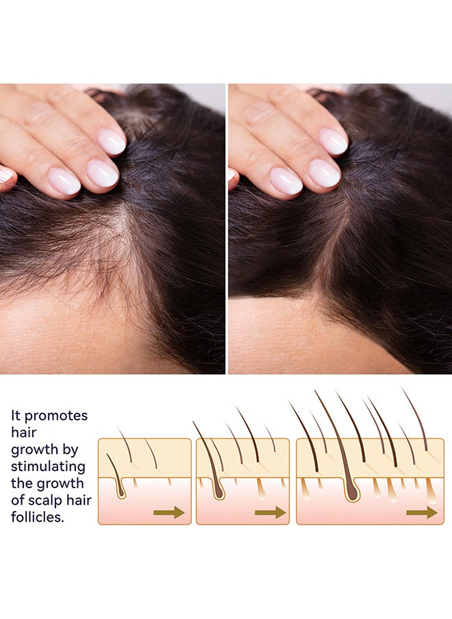 OUHOE - 14 Days Organic Nourishing Hair Care Regrowth Oil Spray Anti Hair Loss Treatment 50ml  Hair Growth Essence For MEN and Women - Image 1