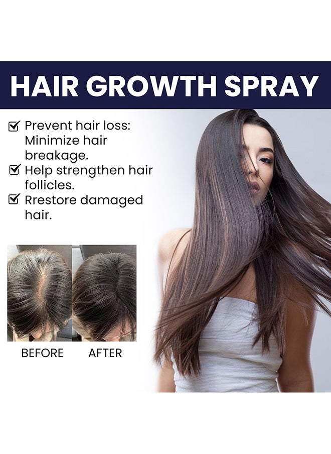 OUHOE - 14 Days Organic Nourishing Hair Care Regrowth Oil Spray Anti Hair Loss Treatment 50ml  Hair Growth Essence For MEN and Women - Image 1