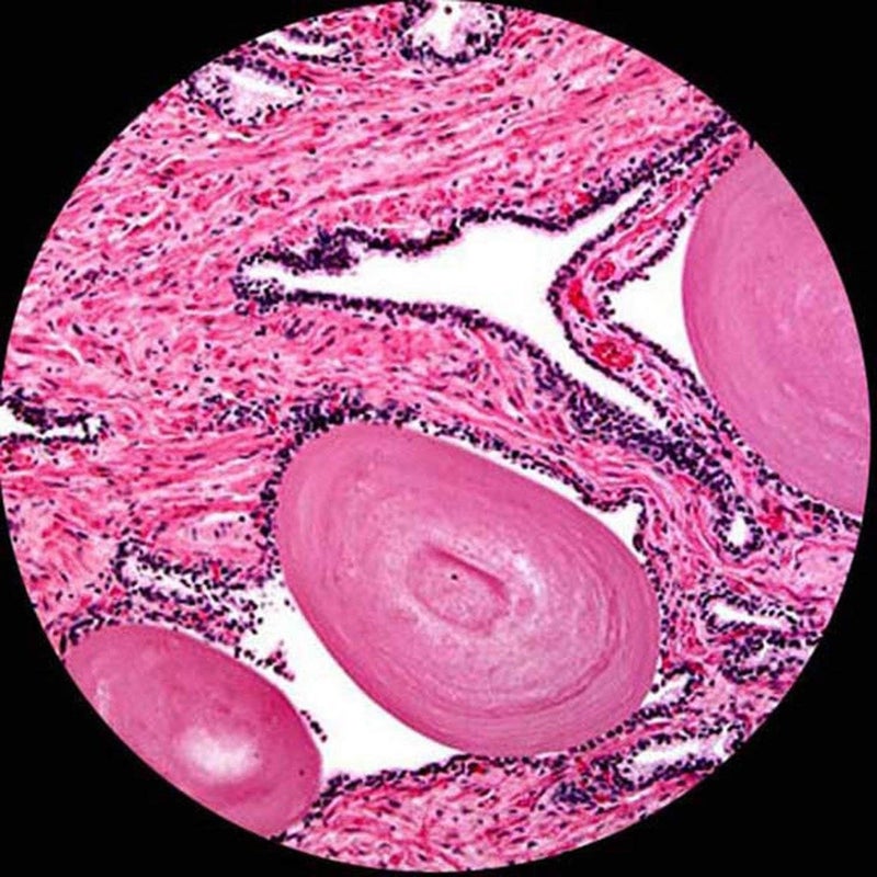 AmScope AmScope M150 Compound Monocular Microscope WF10x Eyepiece 40x400x Magnification LED Illumination Brightfield SingleLens Condenser Coarse and Fine Focus Plain Stage 110V  - Image 4