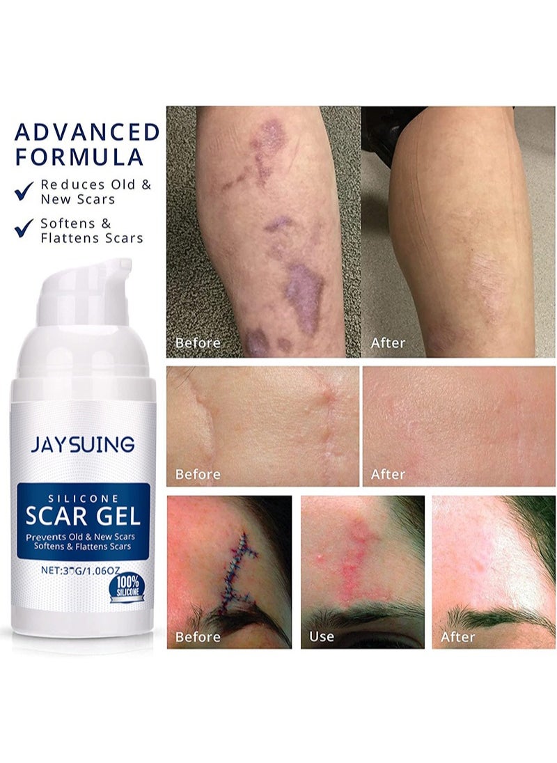 Silicone Scar Gel for Scar Removal,Pharmacist Recommended Scar Therapy Ingredient,Scar Treatment,C-section Scars,Stretch Marks,Acne,Surgery,New and Old Scars - pzsku/Z3D08934C6DD24721FCFEZ/45/_/1739757684/be6c9828-646f-4f61-a9b2-460c2239eb30