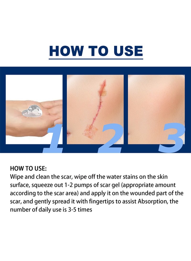 Silicone Scar Gel for Scar Removal,Pharmacist Recommended Scar Therapy Ingredient,Scar Treatment,C-section Scars,Stretch Marks,Acne,Surgery,New and Old Scars - pzsku/Z3D08934C6DD24721FCFEZ/45/_/1739757685/2bc6315e-6a3b-4dc7-8859-149d6bebe1c1