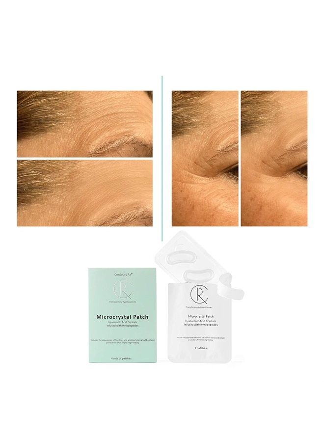 Contours RX Microcrystal Patch Helps Treat Wrinkles, Increase Collagen, Improves Elasticity and Hydrates The Skin - Non-Invasive at-Home Treatment, 4 Sets of 2 Patches - Image 2