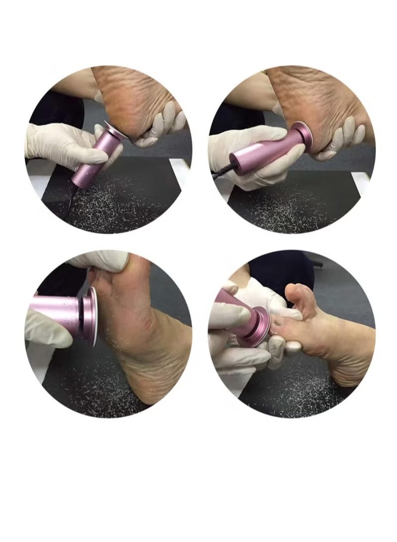 Milatech Electric Callus Remover, Foot File Pedicure Tool with Speed Controller and 60pcs Replacement Sandpaper Disk for Men Women Dead Dry Crack Skin Calluses - Image 3