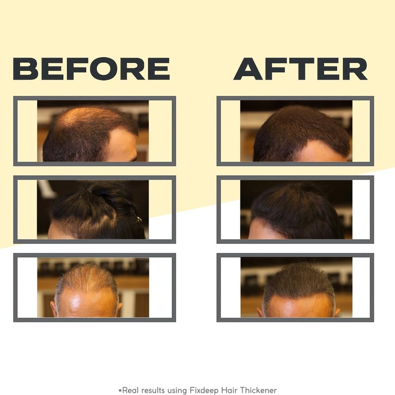 FIXDEEP Hair Thickener | New Waterproof Formula - Natural & Fuller Looking Hair in 30 sec - 14g - Fibers for Thinning, Bald Spots & Graying Roots (Dark Brown) - Image 2