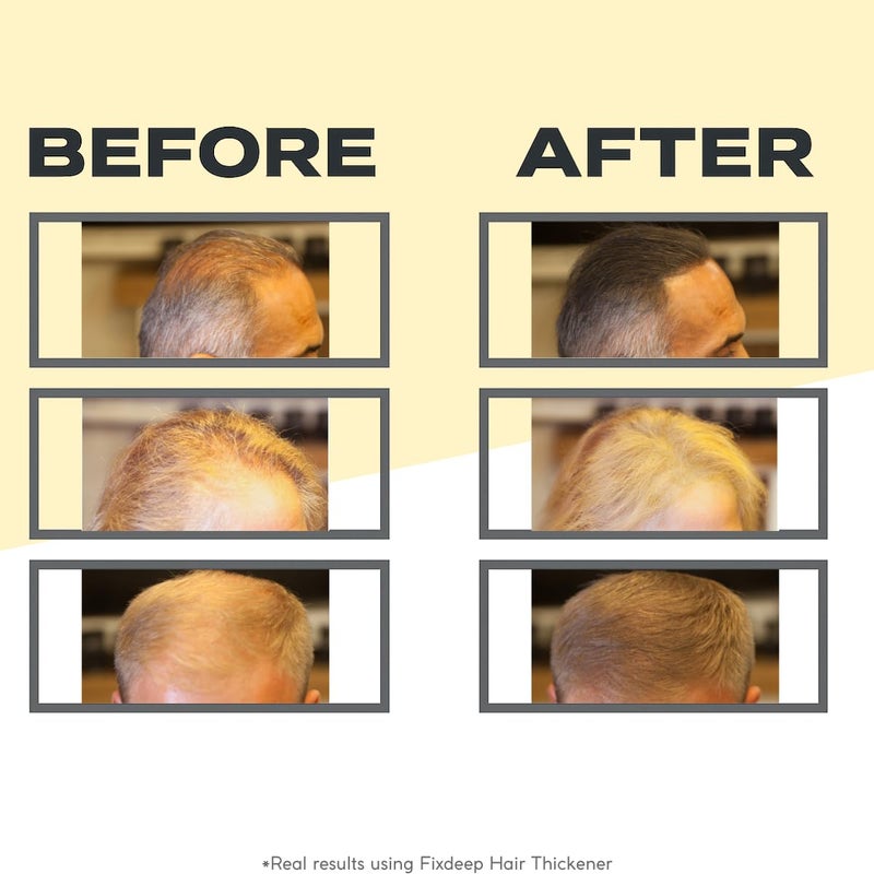 FIXDEEP Hair Thickener | New Waterproof Formula - Natural & Fuller Looking Hair in 30 sec - 14g - Fibers for Thinning, Bald Spots & Graying Roots (Dark Brown) - Image 3