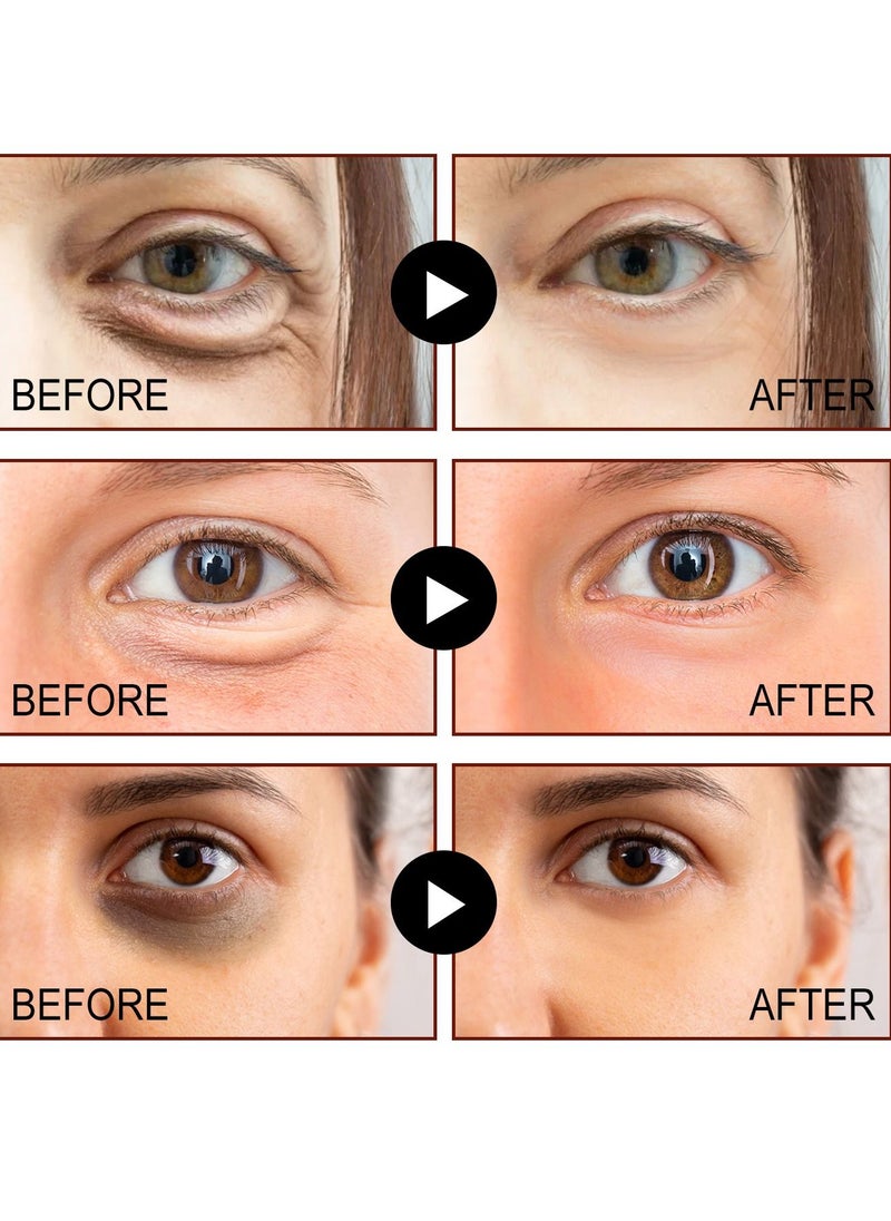 Jaysuing - Repair&Compact Eye Cream Eye Care Eye Cream - Lighten Fine Lines, Eye Bags, Dark Circles, Moisturize, Tighten and Soften the skin around the eyes - Image 1
