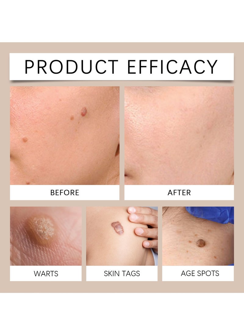 SOUTH MOON - Bee Venom Mole and Wart Care Cream Reduce skin Moles and Warts Clean Repair Smooth skin care cream - Image 1