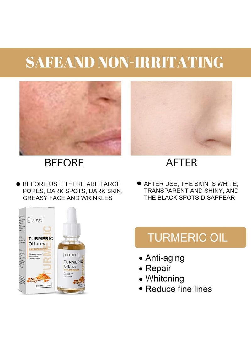 EELHOE - Turmeric Oil Acne Remove Dark Spots Skin Care Lightening, Whitening Serum, Anti Aging Wrinkle, Face Lift, Pigment Corrector, 30ml - Image 1