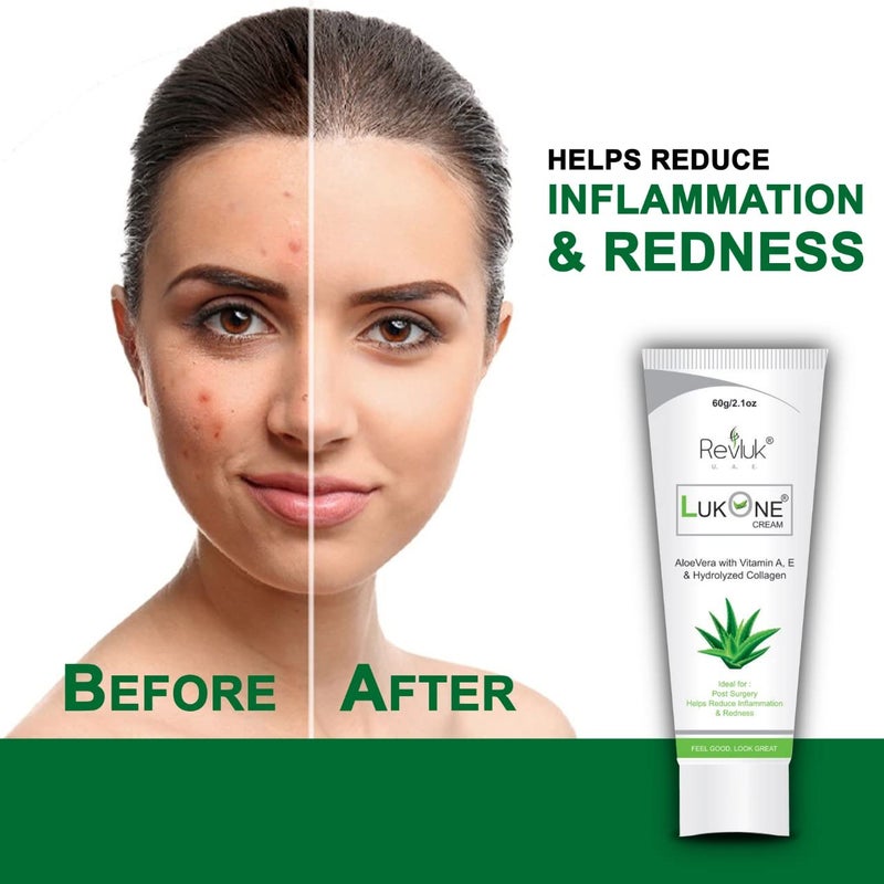 Revluk-Lukone Aloe Vera & Vitamin E Cream - Soothing Relief for Dry, Itchy Skin | Hydrating, Healing Moisturizer for Sensitive Skin | 60 gm - Image 3