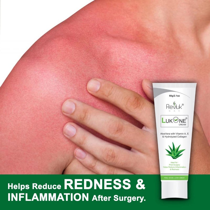 Revluk-Lukone Aloe Vera & Vitamin E Cream - Soothing Relief for Dry, Itchy Skin | Hydrating, Healing Moisturizer for Sensitive Skin | 60 gm - Image 4