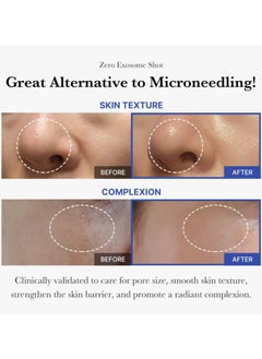 Medicube Zero Exosome Shot 2,000 PPM Spicule Facial Serum | Liquid Skin Booster Serum | Exosome, AHA+BHA+PHA | Pore Minimizer, Dead Skin Cells Improvement | Korean Skin Care 1.01 fl.oz  - Image 2