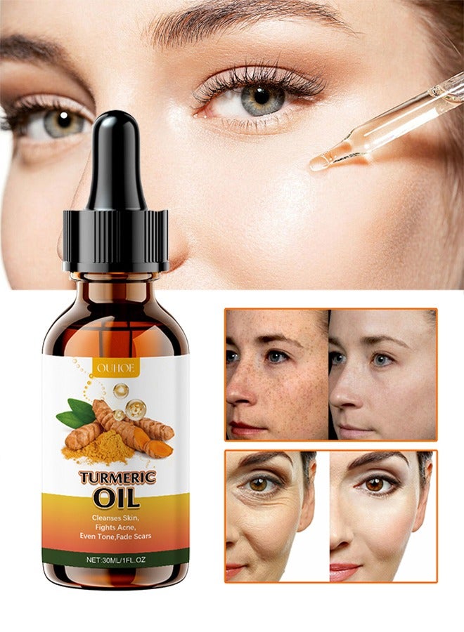 OUHOE Turmeric Oil, Turmeric Dark Spot Correcting Serum Oil, Turmeric Repair Face Serum, Natural Turmeric Bright Skin Dark Spot Skin Care Moisturizing Repair Serum, Turmeric Oil for Face Dark Spots 30ml - Image 1