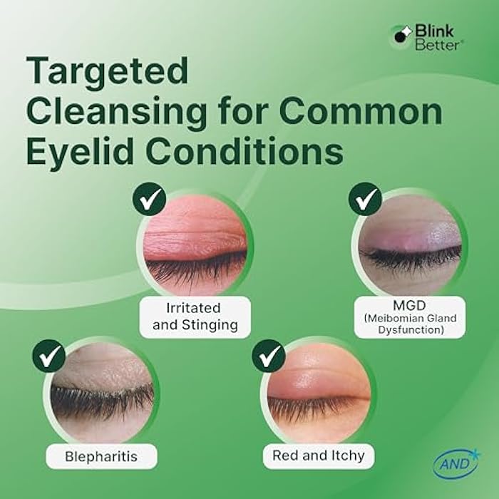 BlinkBetter BetterLids Eyelid Cleansing Gel – Gentle Centella & Tea Tree Extract Cleanser – Refreshes & Cleanses for Daily Eyelid Care – Preservative-Free – 1.06 oz - Image 3