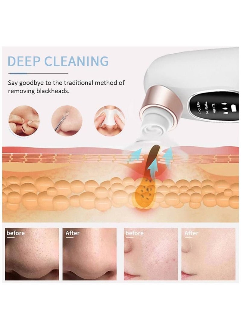 Ru syanl - Facial Acne Blackhead Remover with 6 Suction Heads Face Skin Care Pore Cleaner White - Image 1