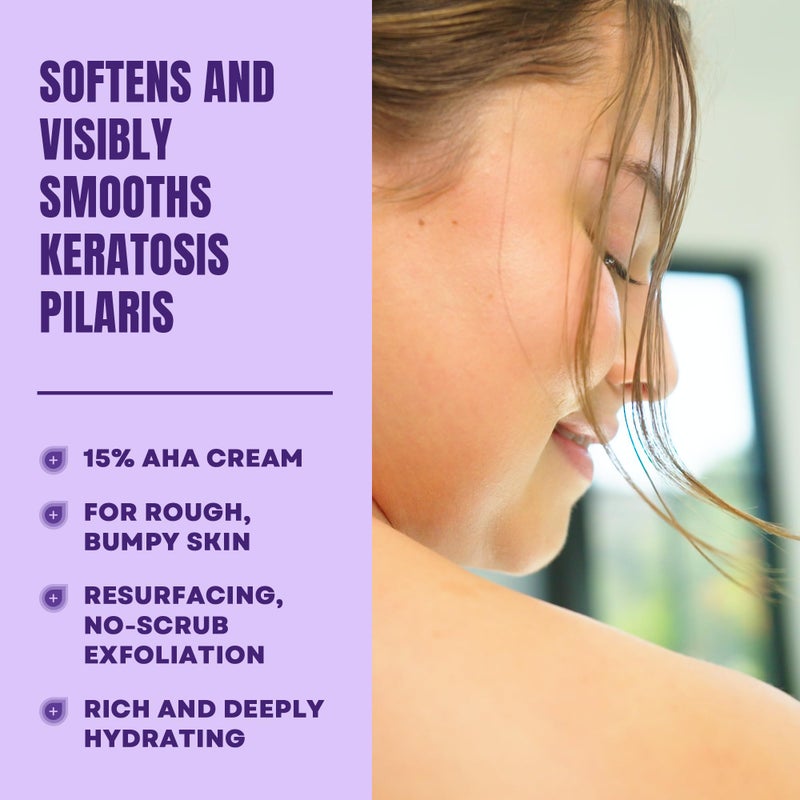 AmLactin أملاكتين KP بامبز بي غون - 3 أونصات كريم مرطب لالتهاب الجريبات الشعرية مع 15% حمض اللاكتيك - مقشر ومرطب للبشرة الجافة والخشنة والمليئة بالنتوءات (قد يختلف التغليف) - Image 2