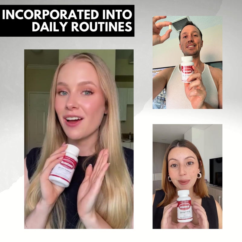 Acnetame Acne Pills 30 Day- Supplements for Acne Vitamin Treatment- Tablets to Clear Oily Skin for Women, Men, Teens, and Adults - Image 2