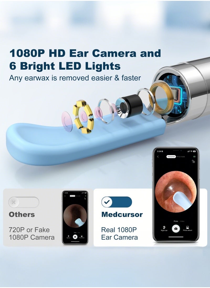 Medcursor - Medcursor Ear Wax Removal, Ear Wax Removal Tool Camera with 1080P HD, Ear Cleaner with 6 LED Lights and 6 Soft Ear Scoops for iOS & Android - Image 1