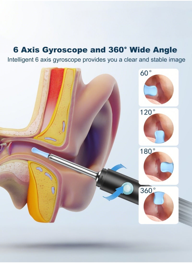 Medcursor - Medcursor Ear Wax Removal, Ear Wax Removal Tool Camera with 1080P HD, Ear Cleaner with 6 LED Lights and 6 Soft Ear Scoops for iOS & Android - Image 1