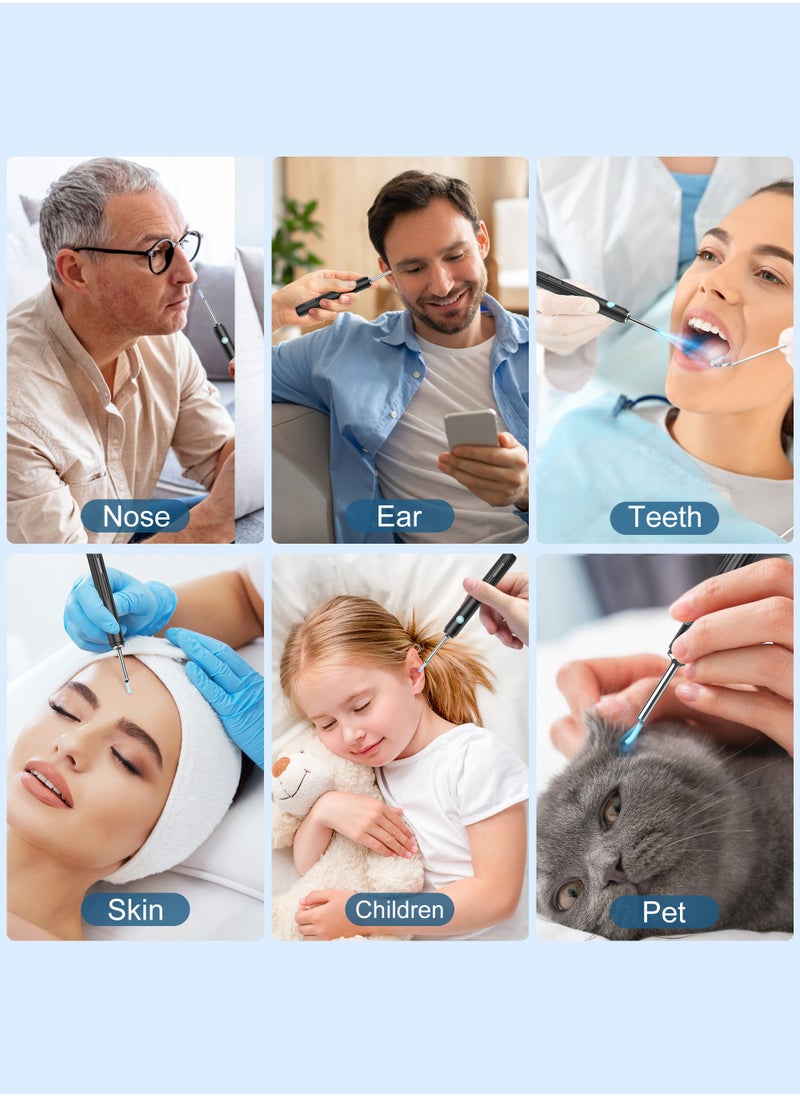Medcursor - Medcursor Ear Wax Removal, Ear Wax Removal Tool Camera with 1080P HD, Ear Cleaner with 6 LED Lights and 6 Soft Ear Scoops for iOS & Android - Image 1