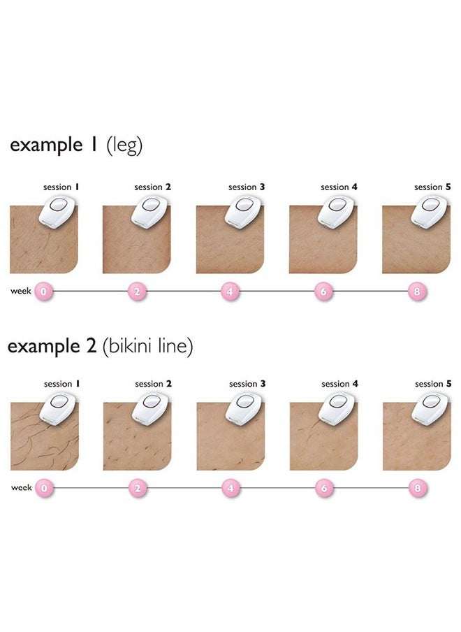 Arabest - 【Efficient & Portable】White Oval IPL Hair Removal Device | Permanent & Painless | Full-Body Use | Easy Operation | Suitable for Men & Women - Image 1