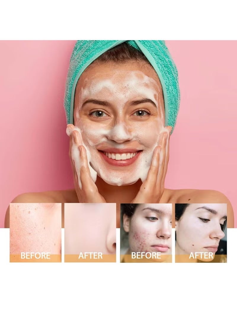 Hoygi Turmeric Face Wash with Brush, Turmeric Foaming Facial Cleanser for All Skin, 3.38 Fl Oz/pcs - Image 5