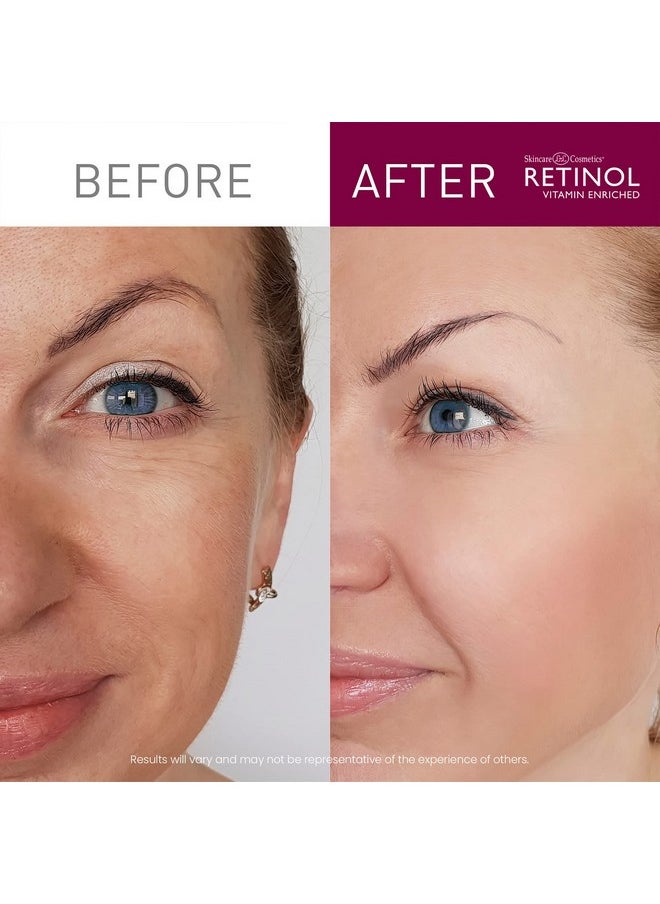 RETINOL - Cream Cleanser Antiaging 5Oz Daily Deep Cleansing Facial Wash Improves Skin Texture Moisturizes And Exfoliates For Softer Face Renewing Vitamin A Minimizes Wrinkles And Fine Lines - Image 1