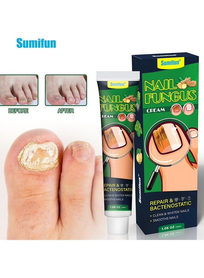 Sumifun Nail Fungus Cream, Extra Strength Nail Repair Cream, Toenail Fungus Treatment Cream, Cleans & Whitens & Smooths Nails, Repairs Bacteriostatic 30g - Image 1