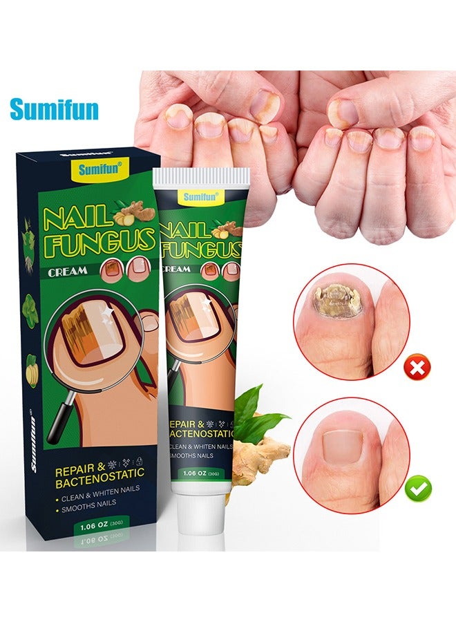 Sumifun Nail Fungus Cream, Extra Strength Nail Repair Cream, Toenail Fungus Treatment Cream, Cleans & Whitens & Smooths Nails, Repairs Bacteriostatic 30g - Image 2