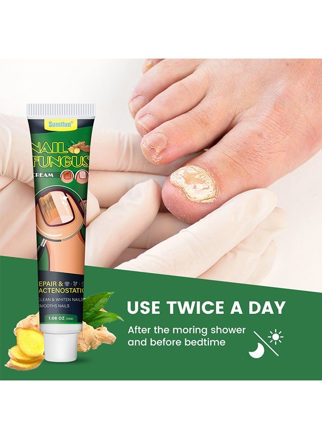 Sumifun Nail Fungus Cream, Extra Strength Nail Repair Cream, Toenail Fungus Treatment Cream, Cleans & Whitens & Smooths Nails, Repairs Bacteriostatic 30g - Image 3