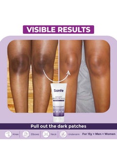 Sanfe Instant Spotlite Mask For Dark Underrams, Neck & Body| Dark Patch Removal Wipe-Off Cream In 10 Minutes | For Detanning, Anti Aging & Skin Tightening | Glycolic & Kojic Acid With Charcoal 100G  - Image 2