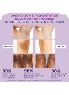 Sanfe Instant Spotlite Mask For Dark Underrams, Neck & Body| Dark Patch Removal Wipe-Off Cream In 10 Minutes | For Detanning, Anti Aging & Skin Tightening | Glycolic & Kojic Acid With Charcoal 100G  - Image 5