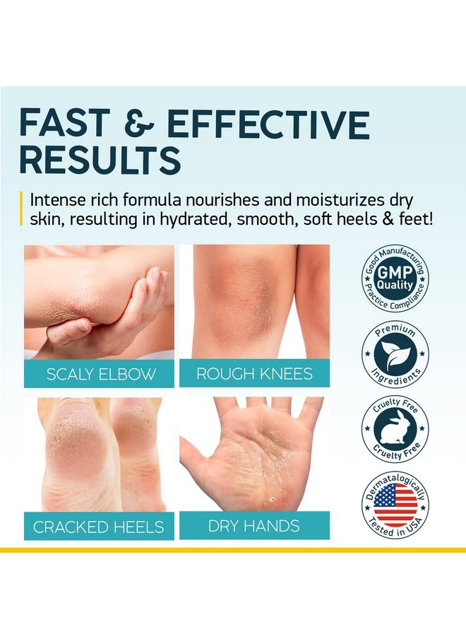 Nuvadermis - Urea Cream 40 Percent For Feet 40% Urea Foot Repair Lotion Maximum Strength For Dry Cracked Heels 2% Salicylic Acid Shea Butter Tea Tree Oil Vitamin E 5.29 Oz Jar - Image 1