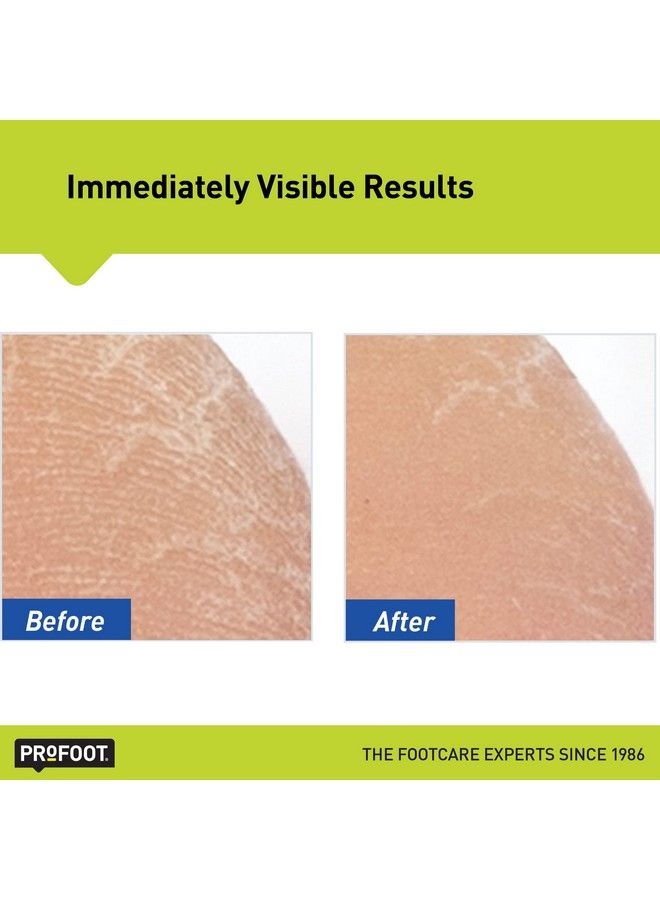 ProFoot Heel Rescue Foot Cream 16 Ounce Bottle 2 Pack For Cracked Calloused Or Chapped Skin - Image 5