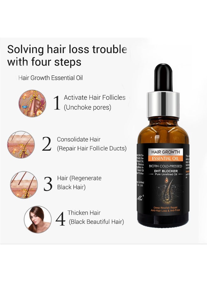 Original Ginger Hair Essential Oil Scalp Care No-Wash Hair Care Massage Essential Oil 30ML - Image 2