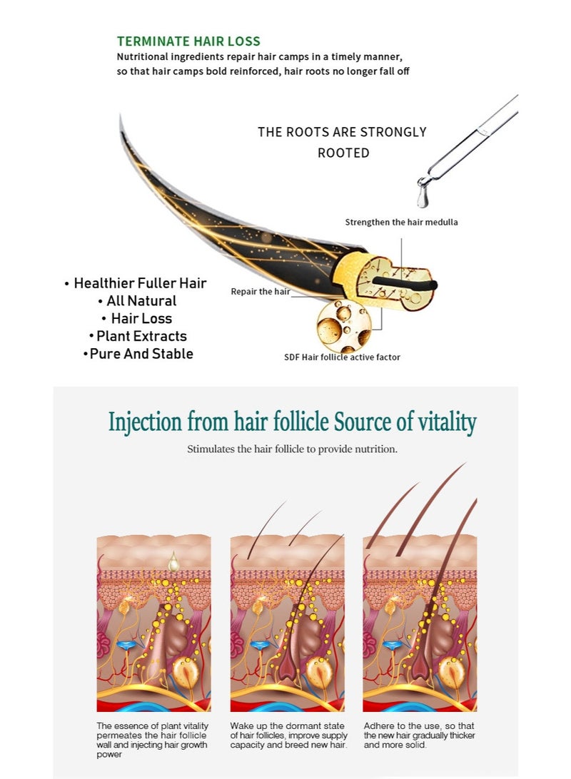 Original Ginger Hair Essential Oil Scalp Care No-Wash Hair Care Massage Essential Oil 30ML - Image 4