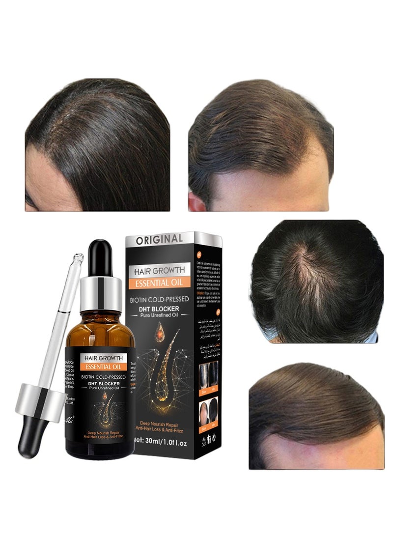 Original Ginger Hair Essential Oil Scalp Care No-Wash Hair Care Massage Essential Oil 30ML - Image 1