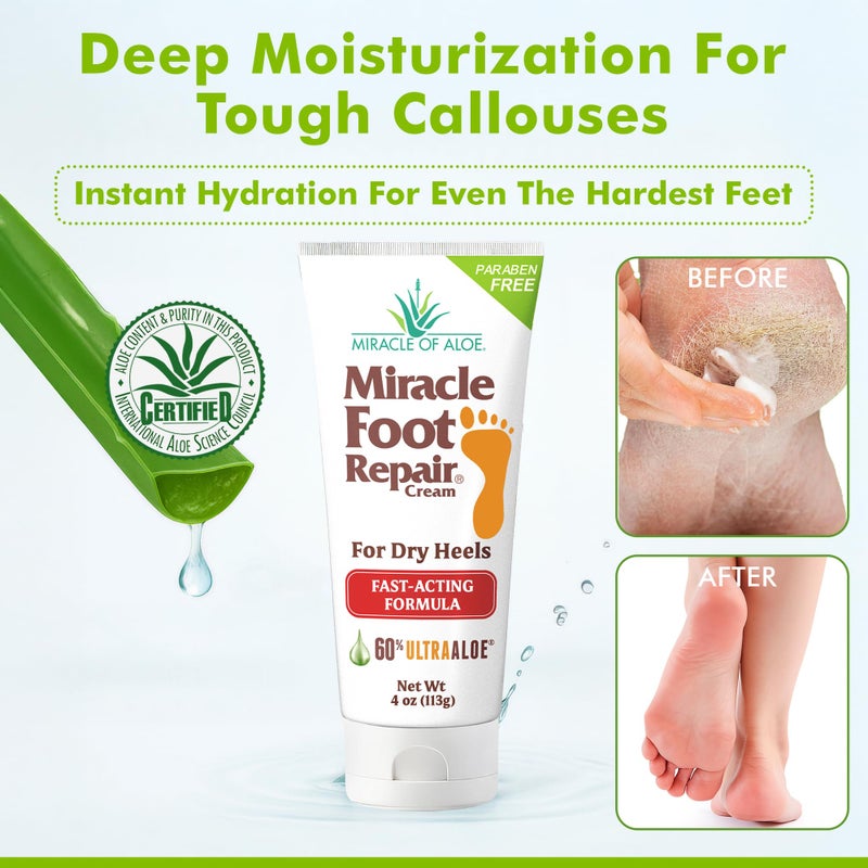Miracle of Aloe Miracle Foot Repair Cream, 4 oz Repairs Dry Cracked Heels and Feet, Diabetic-Safe, 60% Pure Ultra Aloe Moisturizes, Softens, and Repairs, Relief from Discomfort of Ingrown Toenails (2-Pack) - Image 3