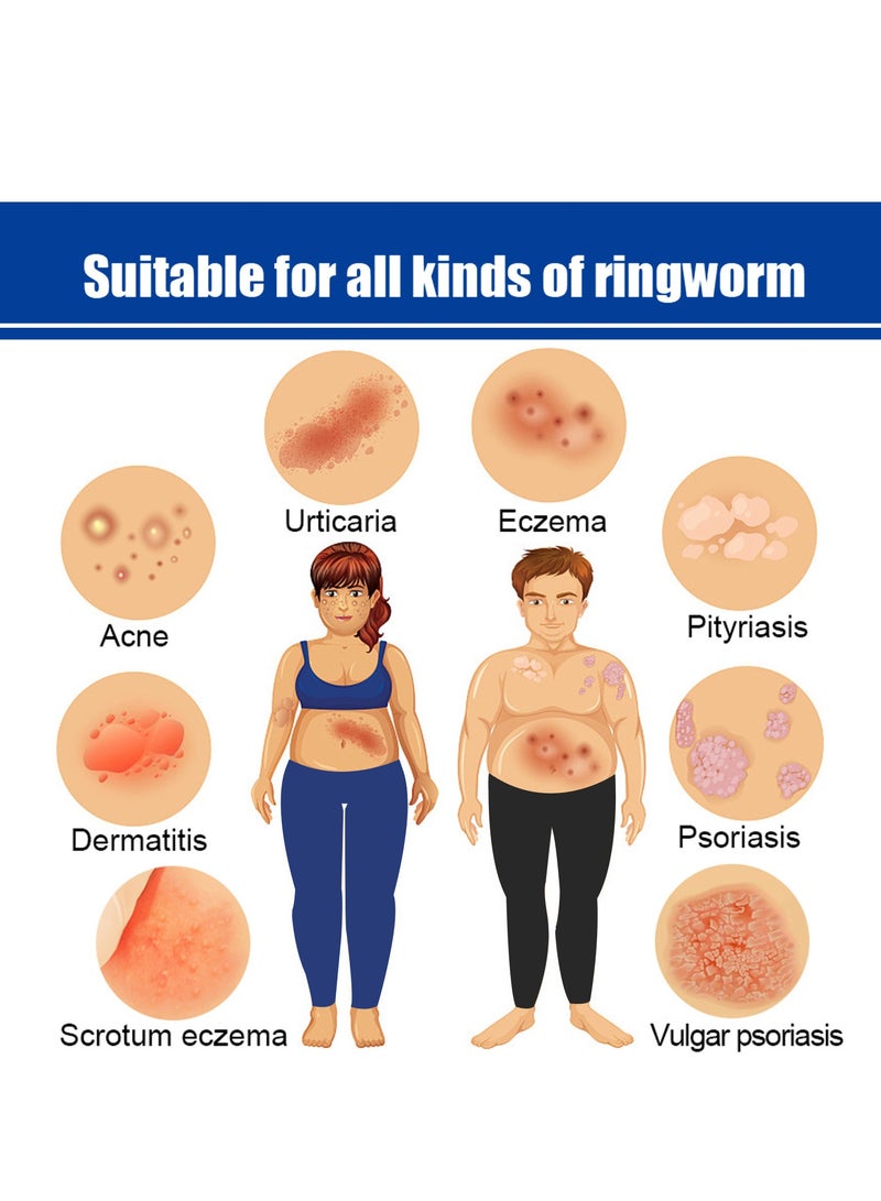 ساوث مون كريم مضاد للبكتيريا للصدفية والأكزيما كريم مضاد للفطريات ، يساعد على الأكزيما ، كريم مضاد للسعفة مضاد للحكة بمكونات عشبية ألطف وأكثر أمانا يعيد الحكة بسرعة للوجه والجسم 20 جرام - Image 4