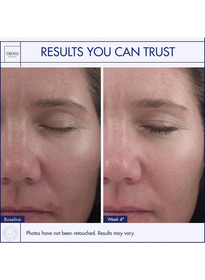 Obagi Medical Bagi Medical 360 Retinol 1.0 Cream Retinol Face Cream For Acne Treatment & Skin Discoloration Advanced Creambased Formula To Minimize Facial Lines & Wrinkles Antiaging Face Moisturizer 1 Oz - Image 5