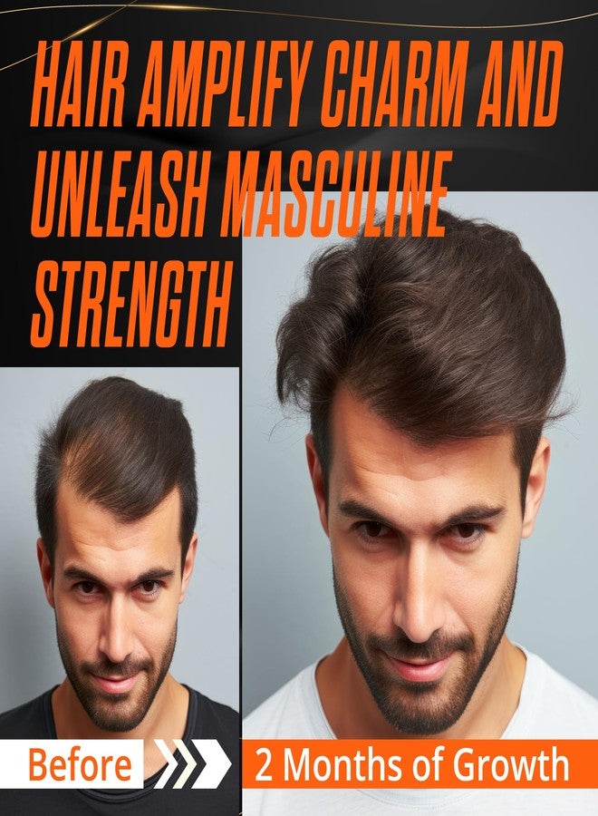 Abera Hair Growth Serum for Hair Loss, Natural Hair Regrowth Treatment for Hair & Beard with Biotin & Castor Oil - Image 4