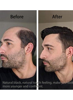 Y&D Men's Clips-On Short Hair Toupee, European Human Toppers Hairpiece for Head Top Replacement System in Black, Perfect Weddings, Parties, and Daily Use  - Image 2