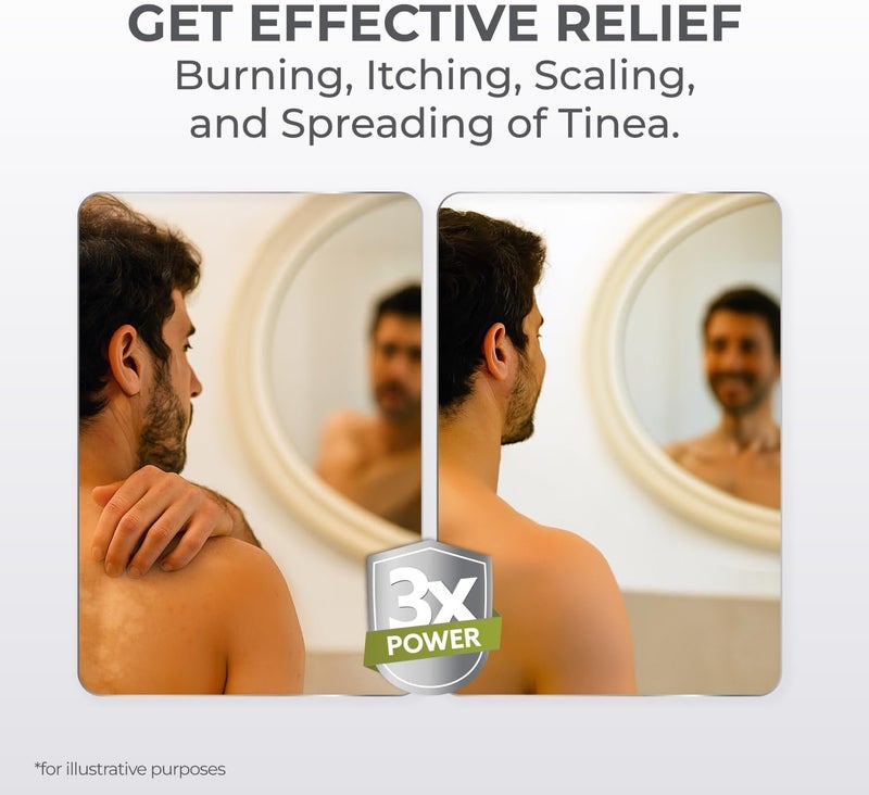 Terrasil Tinea Versicolor Treatment Cream Max Strength, Antifungal Tinea Cream, Clinically Proven 1% Clotrimazole. Treats Most Ringworm & Fungal Infections. Soothing Relief of Itchy Dry Skin (7oz) - Image 4