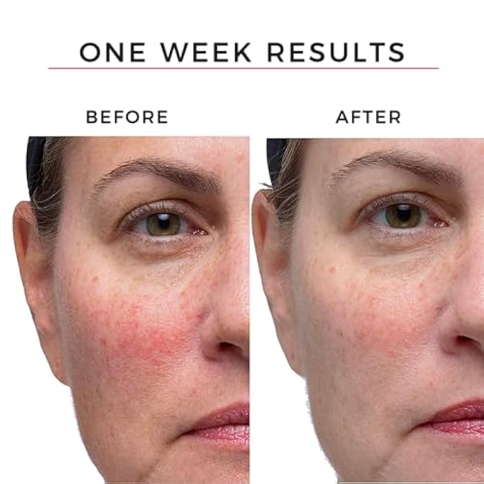 Hey Honey Good Morning Honey Silk Facial Serum | Anti-Aging Vitamin C & Hyaluronic Acid Serum for Radiant Skin Boosts Glow, Smooths Fine Lines, Strengthens Skin Barrier | 1 oz - Image 3