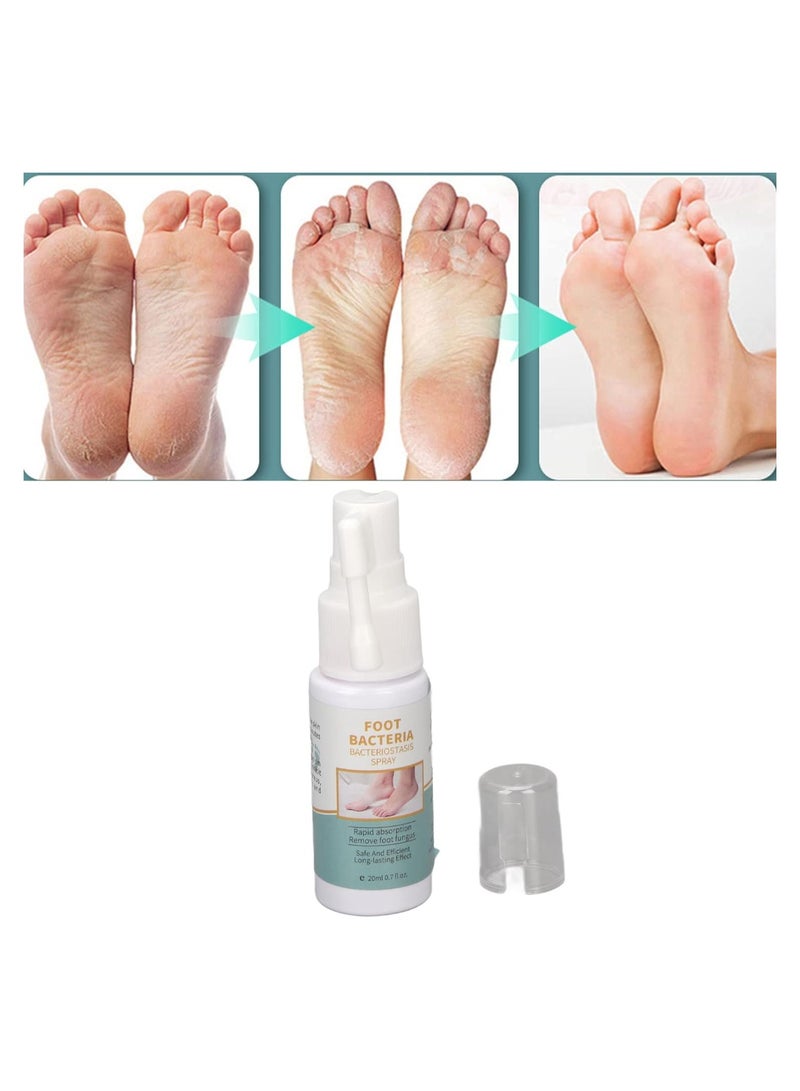DubaiGallery 30Ml Foot Treatment Mild Foot Treatment Odor Gentle Peeling Foot Spray Gentle Feet For Serums Spraye Peeling Foot Treatment Spray - Image 4